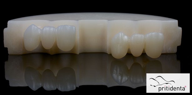 Zirkonoxid-Ronden in multicolor hochtransluzent