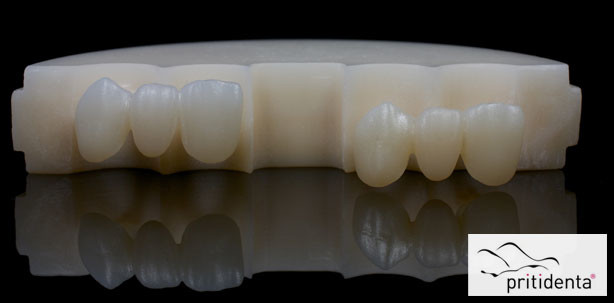 Zirkonoxid-Ronden in multicolor hochtransluzent