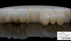 Zirkonoxid-Ronden in multicolor hochtransluzent
