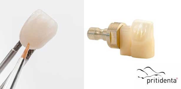 Ästhetische Verbesserung ist gefragt