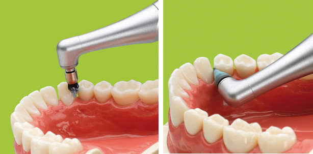 Prophylaxe – starke Instrumente für eine starke Disziplin