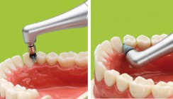 Prophylaxe – starke Instrumente für eine starke Disziplin