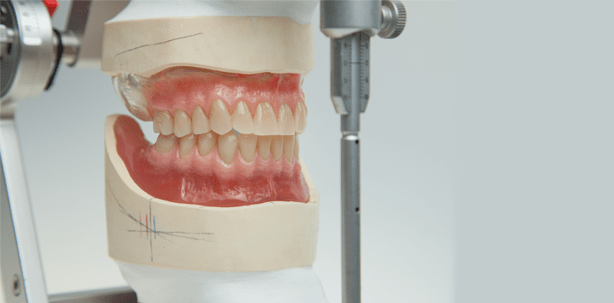 Schleimhautgetragene OK- und UK-Totalprothese