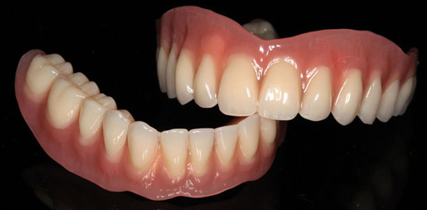 Erweiterte Indikation: Konusprothesen auf individuellen Abutments