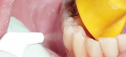 Neue Trends im Bereich der Pulverstrahltechnologie