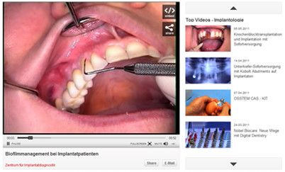 Klinische Videos auf ZWP online