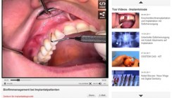 Klinische Videos auf ZWP online