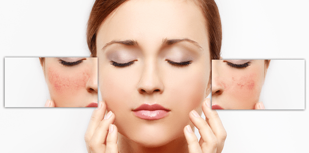 Misslungene kosmetische Behandlung: Zahnarzt muss zahlen