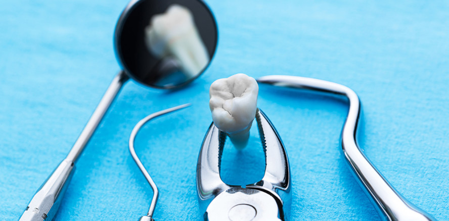 Studie: Rauchen erhöht Risiko für Zahnverlust