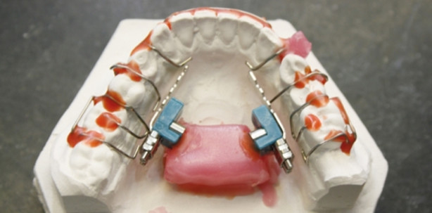 Die labortechnische Herstellung der Rückschubdoppelplatte