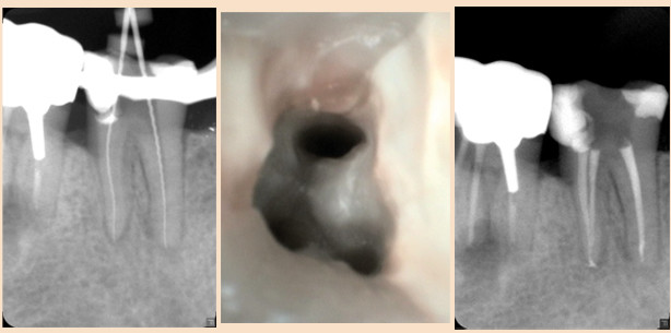 Vereinfachte Behandlung mit einem modernen Konzept