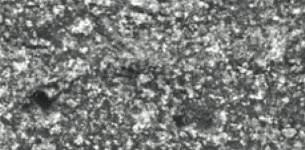 Signifikante Reduktion der Schmerzempfindlichkeit