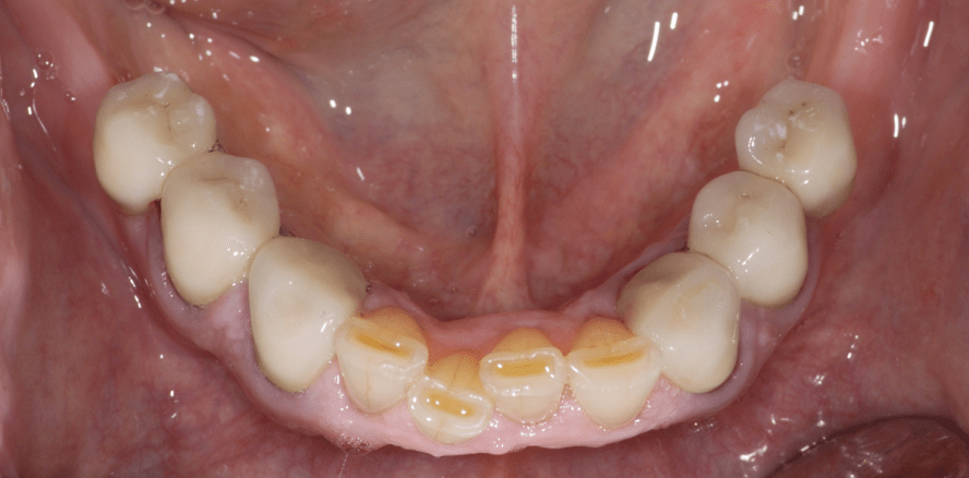 Sind betagte Patienten besondere Patienten?