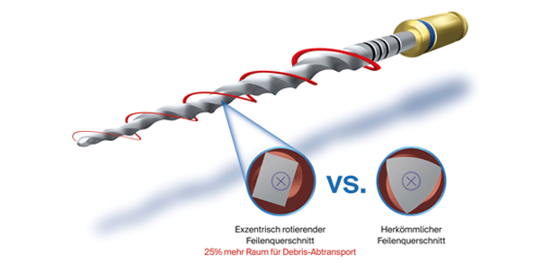 Restaurative Zahnheilkunde und Endodontie werden zum unzertrennlichen Paar