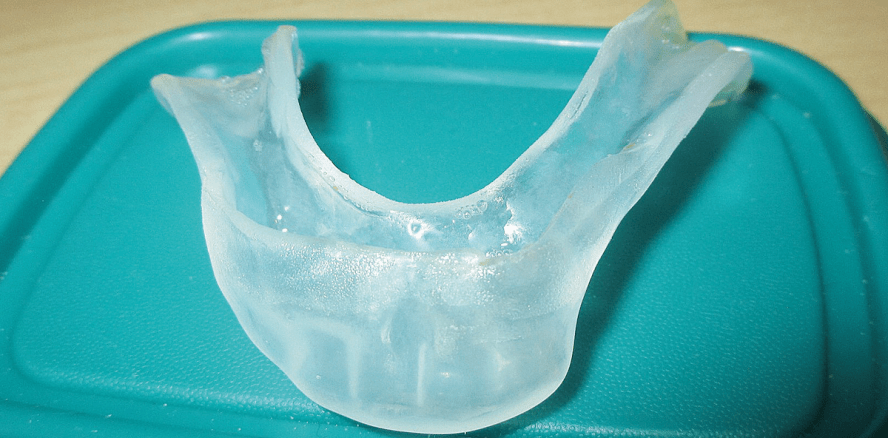 Patienten unter Tumortherapie: Intensive Betreuung der Mundhöhle