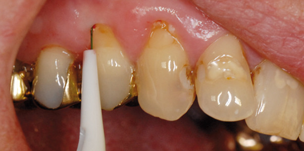 Risikobasierte Prävention
