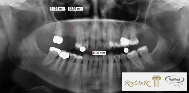 Innovation für die klassische Röntgendiagnostik