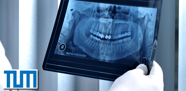 Mit „speckles“ bessere Röntgenbilder erzielen