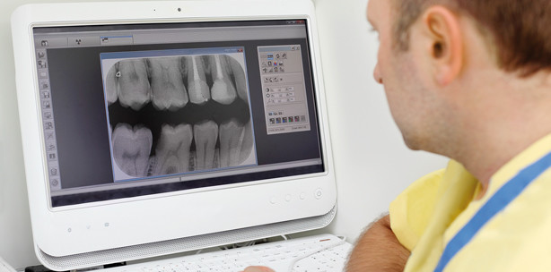 Erforderliche Röntgenaufnahmen bei Wurzelfüllungen
