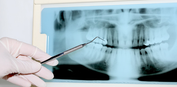 Röntgen: Strahlenanwendung muss fundiert begründet sein