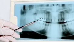 Röntgen: Strahlenanwendung muss fundiert begründet sein