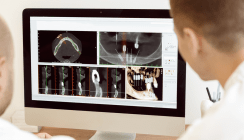 Durchbruch in der zahnmedizinischen Bildgebung