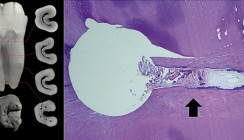 SAF-System – Teil 3