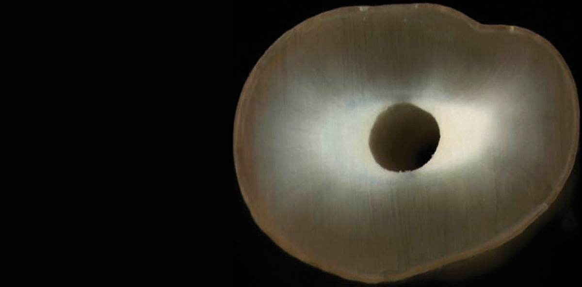 SAF-System – Teil 4: Erhaltung der Integrität der Zahnwurzel