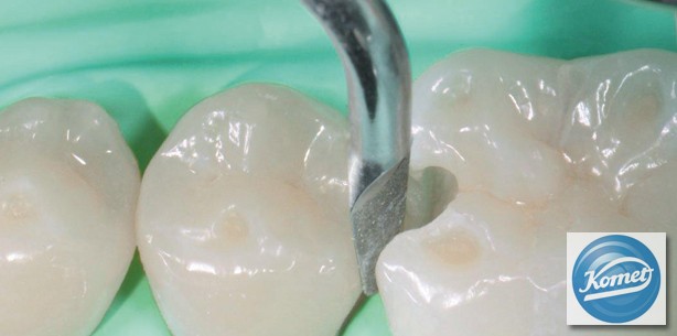 Fachdental Leipzig: Durchdachtes System der Schallspitzen