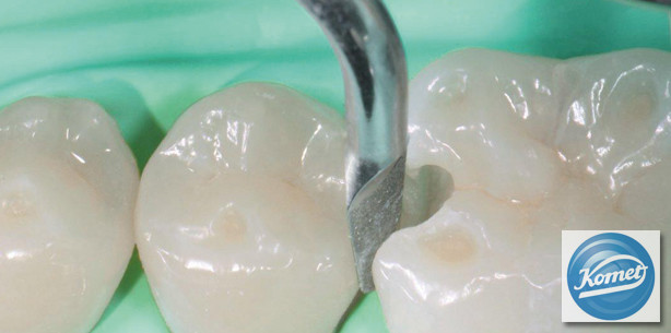 Fachdental Leipzig: Durchdachtes System der Schallspitzen