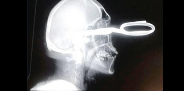 „Gentleman“ überlebt schwere Gesichtsverletzung