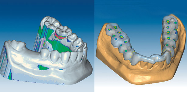 Step by Step zur therapeutischen Schiene