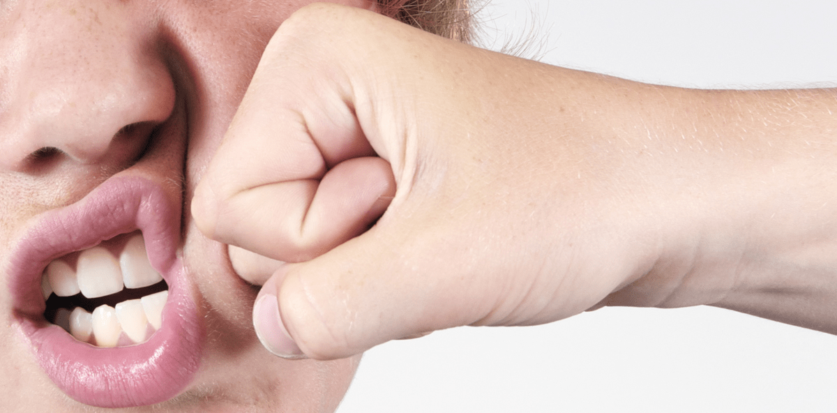 Zugeschlagen: Teenager hat Zahn in Hand stecken