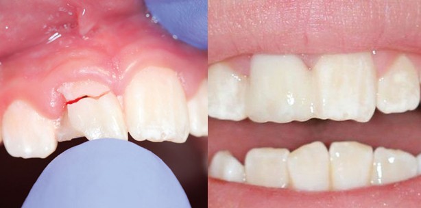 Schnelle Versorgung auf zuverlässiger und stabiler Basis