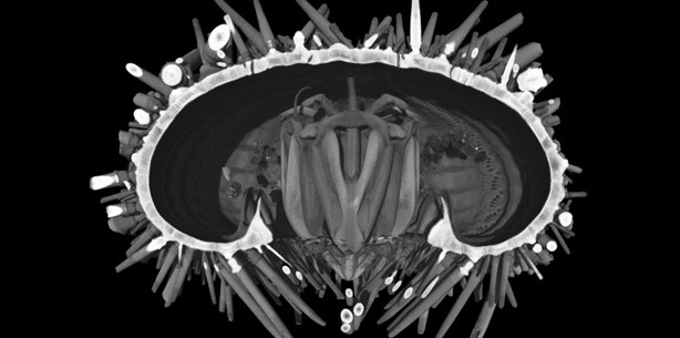 Neuer Kaumuskeltyp entdeckt