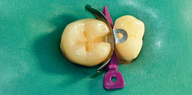 Althergebrachtes und Innovationen in der Zahnheilkunde