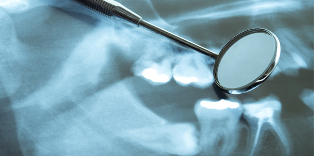 Zahnpflege in Heimen könnte besser sein