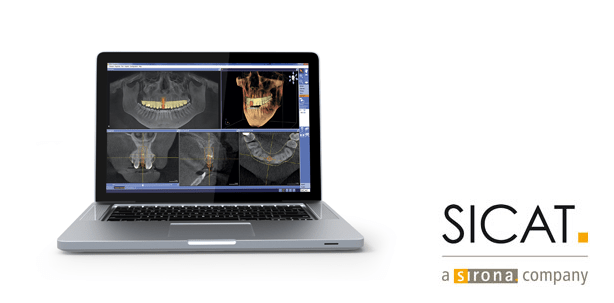Fortbildung mit SICAT: Sicher implantieren mit 3D-Planung und Bohrschablone