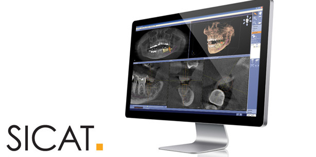 Jetzt SICAT Bohrschablonen kostenlos testen