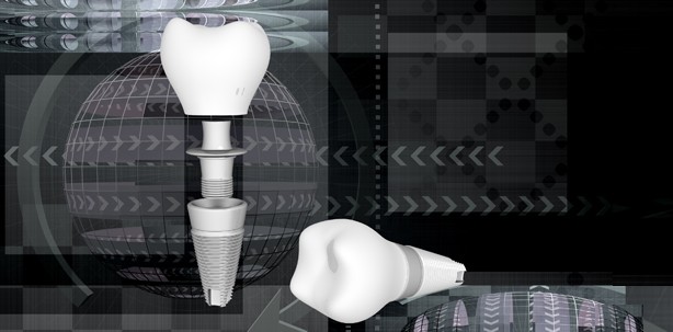 Nano-Silber verbessert Implantate