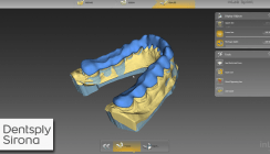 CAD/CAM-Endspurt 2016: Dentsply Sirona präsentiert inLab CAD Software 16.0