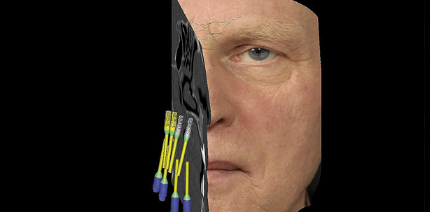 Smile 3D – Röntgendiagnostik 2.0