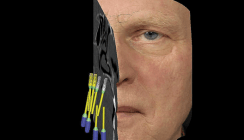 Smile 3D – Röntgendiagnostik 2.0