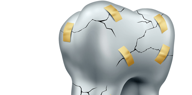 Saft- und Sodatrinker haben ein erhöhtes Risiko für Zahnerosionen