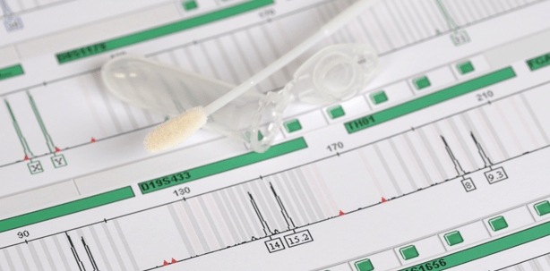 Autismus-Diagnose bald durch Speichel?