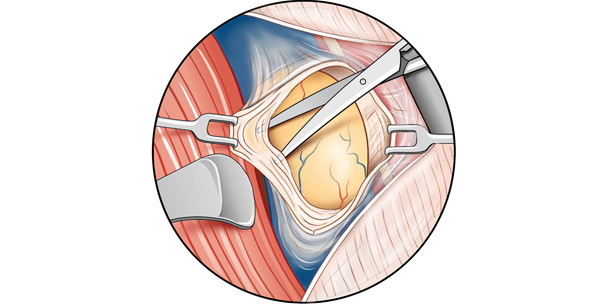 Erkrankungen der Speicheldrüsen –  Teil IV: Hints & Tricks