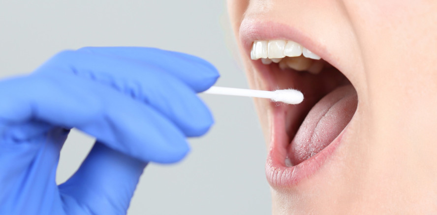 Speicheltest soll Auskunft über Parodontitis geben