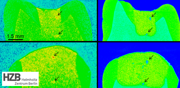 Wie gelingen stabilere Zahnfüllungen?
