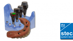 StecoTitanmagnetics® für Conelog® Implantate