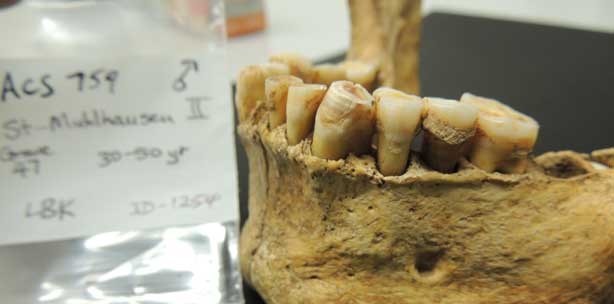 Zahnstein gewährt Einblick in die Evolutionsgeschichte